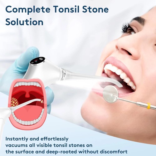 Набір для видалення каміння з мигдаликів Tonsil Stone Remover Kit Electronic Vacuum White